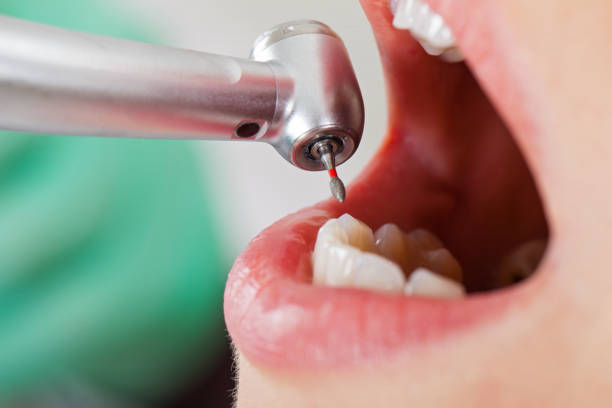 Best Broken or Chipped Tooth Repair in Meadowood, PA
